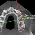 Стоматологическое отделение Арбатский в Гагаринском переулке Фотография 6